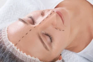 Rhinoplasty Turkey Price What You Should Know