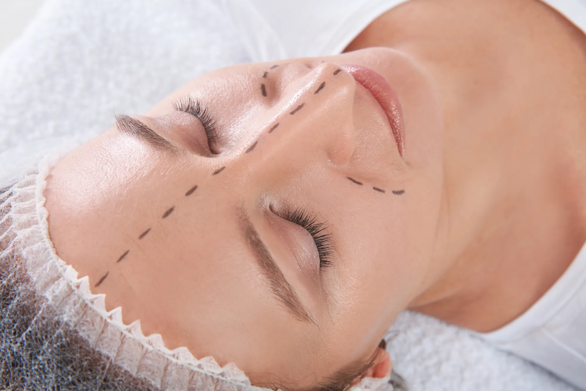 What Is the Real Rhinoplasty Turkey Price?